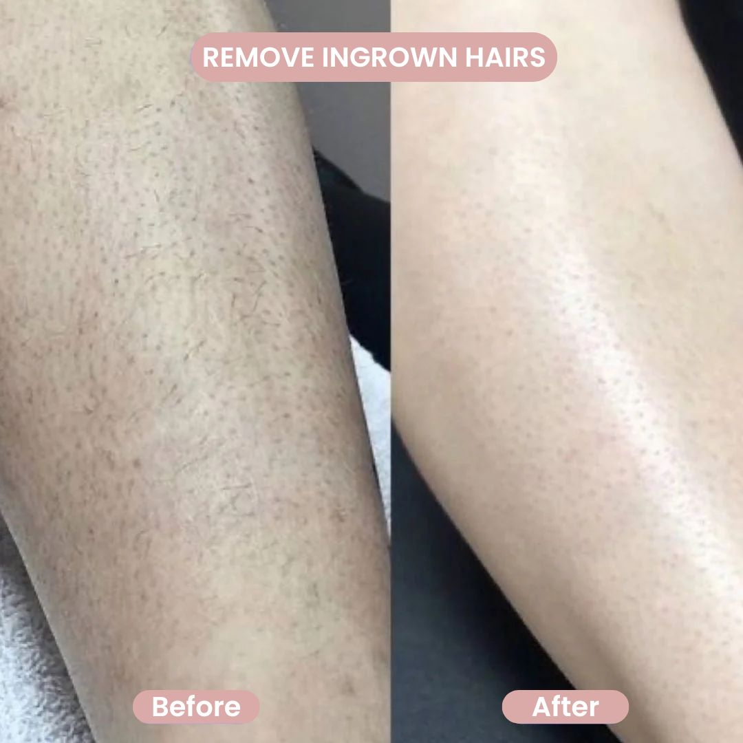 Smooth Body Shaver ™