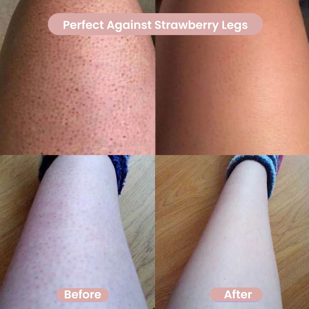 Smooth Body Shaver ™